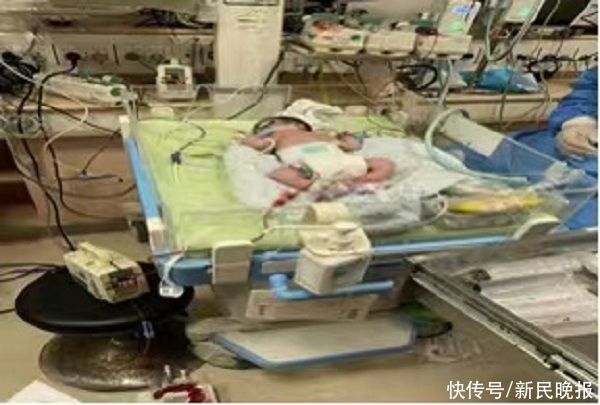 生育|“熊猫血”妈妈生育二胎有顾虑？市六医院为她全周期保驾护航