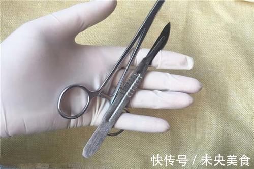 医生|癌症患者该不该选择化疗？化疗有没有副作用？医生如实相告