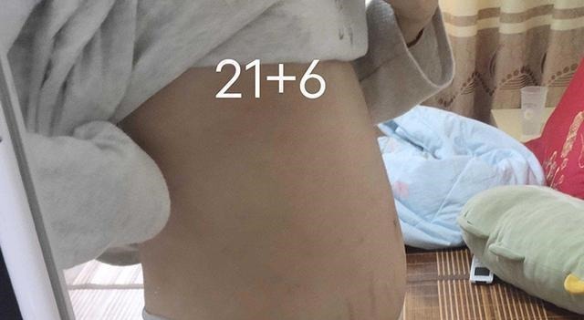 添加|这几种水果尽量别给娃吃,尤其是1岁左右的宝宝,辅食添加需谨慎