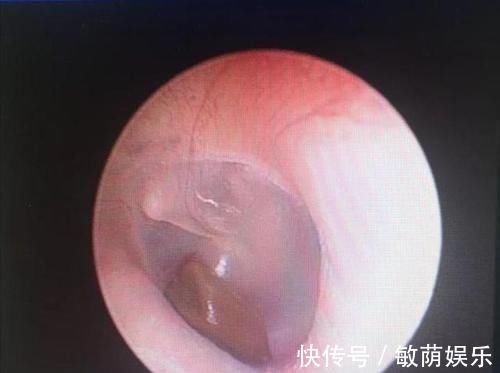 医院|2岁女童在游乐园突然抠耳朵,连送4家医院,取出的东西让父母崩溃