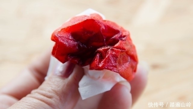 高血压身上出现3个异常信号,提示你血压太高,一旦忽视很危险