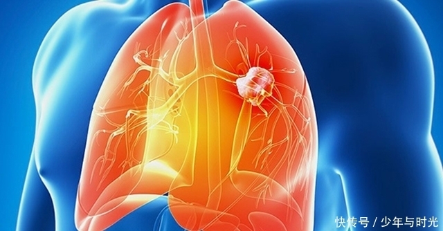 养肝|养肝“第一宝”找到了,每周2次,肝经通了,肝炎不来扰