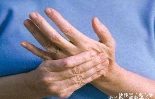 增加|冬季是血栓高发季,生活中我们应该如何预防血栓的形成呢?