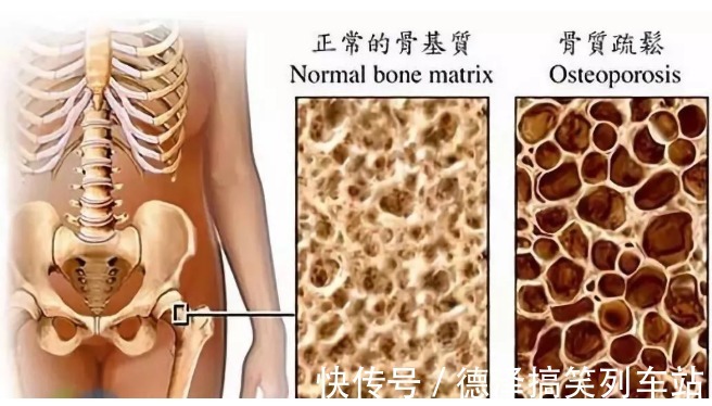 常见病|再次提醒：过65岁后，老年人要舍得补充这3种营养，预防3种常见病