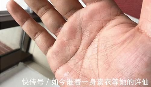 肝部|肝部变硬时,身体会出现4个“异象”,早点发现,肝脏或还有的救