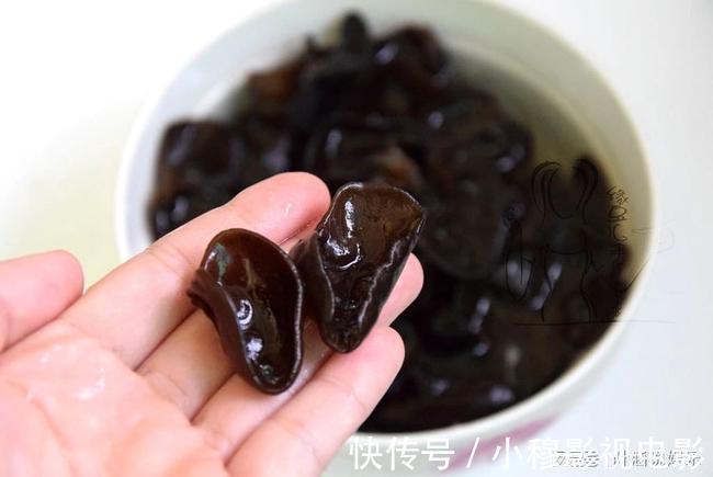 老张|夫妻二人频繁腹泻肝癌后离世,医生:3物天天吃等于自找“西天”