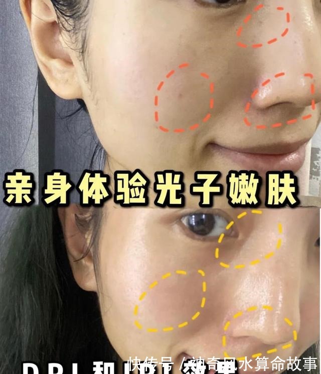 差距 为什么光子嫩肤价格差距这么大!