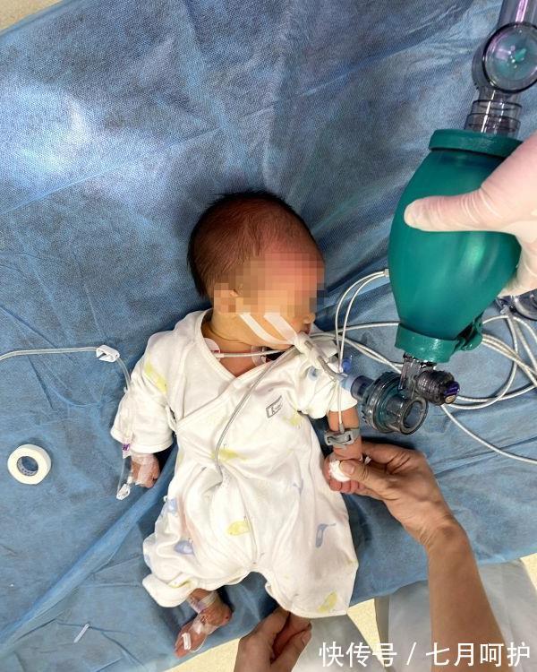 海姆立克|感谢!出生仅7天宝宝呛奶窒息,医生坚持抢救1小时救回