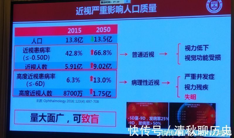 眼球|近视的眼球如同一个吹大的气球,近视度数越高,气球越大,越危险