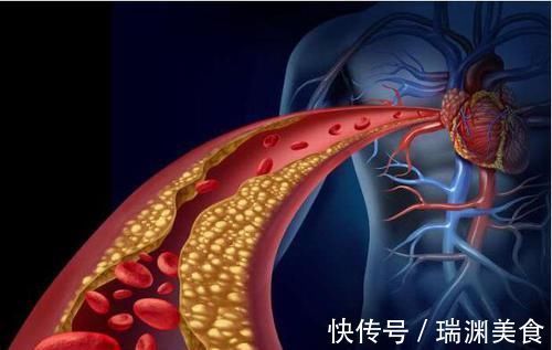 健康|无论男女，若能顺利做2个动作，恭喜你！血管很健康，不妨试试