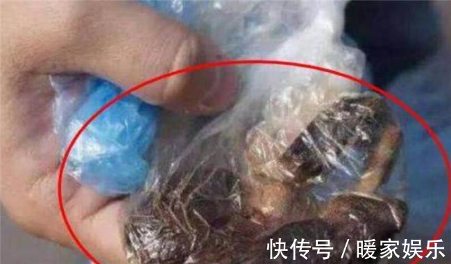 流产|夫妻备孕5年没怀上,去医院检查,医生却告知妻子已经怀孕7年