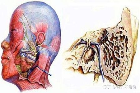 肿瘤|面瘫反复发作，有可能是面神经肿瘤在作怪！