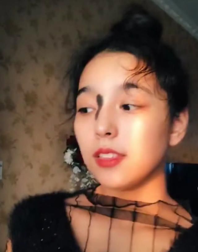 孕期|胎记到底是怎么来的医生孕期避开这3种行为,可减少胎记产生