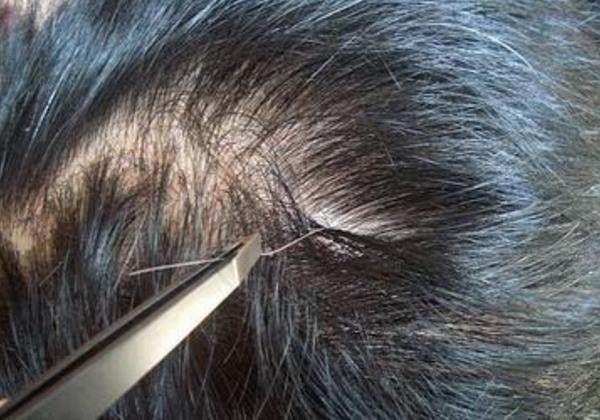 乌发|白发的救星来了，坚持每天饭后喝点它，据说比染发还管用