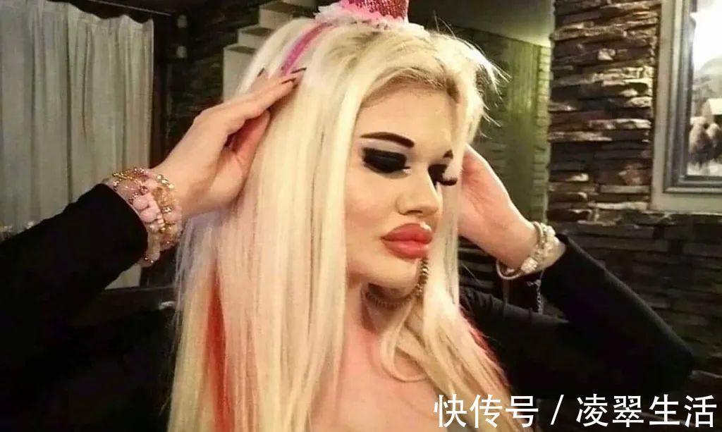 sofia 21次丰唇手术之后,这个妹子的嘴唇现在长这样…