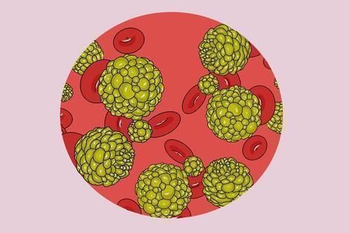 患者|癌症的扩散速度决定患者生存时间?扩散的症状、原因,患者需了解