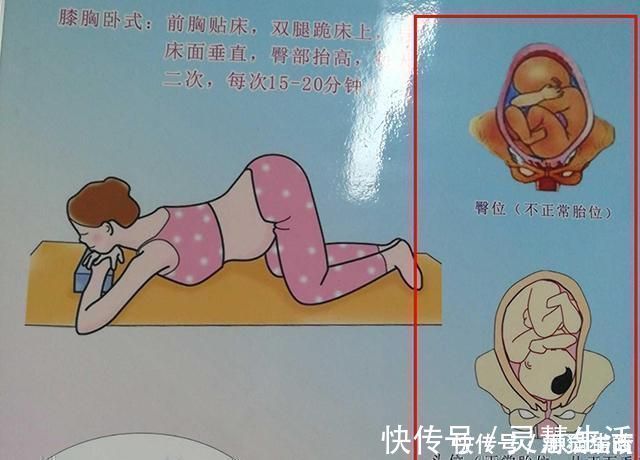 二胎|头胎选择剖腹产,二胎可以顺产吗?若孕妈是这三种情况,就别想了