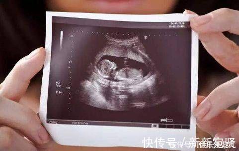 着床|怀孕B超检查太早没意义，太晚又天天担心，而这个孕周刚好！