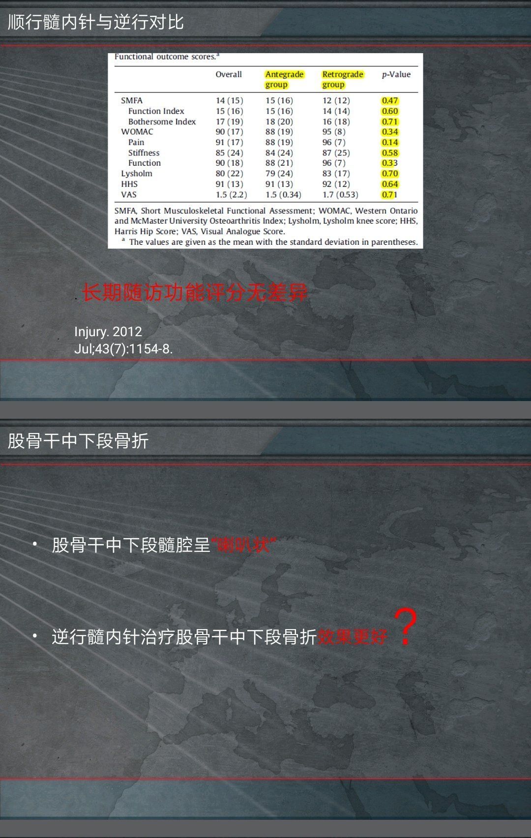 骨髓腔|交锁髓内针治疗股骨干骨折