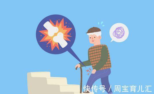 养骨|激活骨细胞“冠军”找到了，不是钙片，坚持2件事，或有助于养骨
