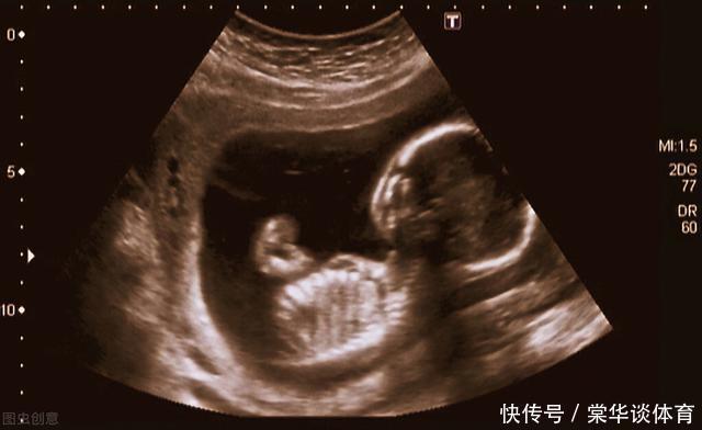 手术|妻子怀孕20周,产检时被告知胎儿没有肺,夫妻俩依然决定留下这个孩子