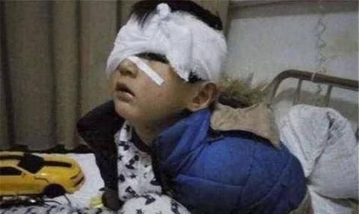 后脑勺|这4个部位是孩子“生命线”,家长再生气也别打,后果你承受不起