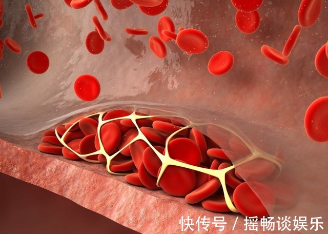 心血管疾病|每天做俯卧撑好吗?经常做俯卧撑,4件好事自动上门