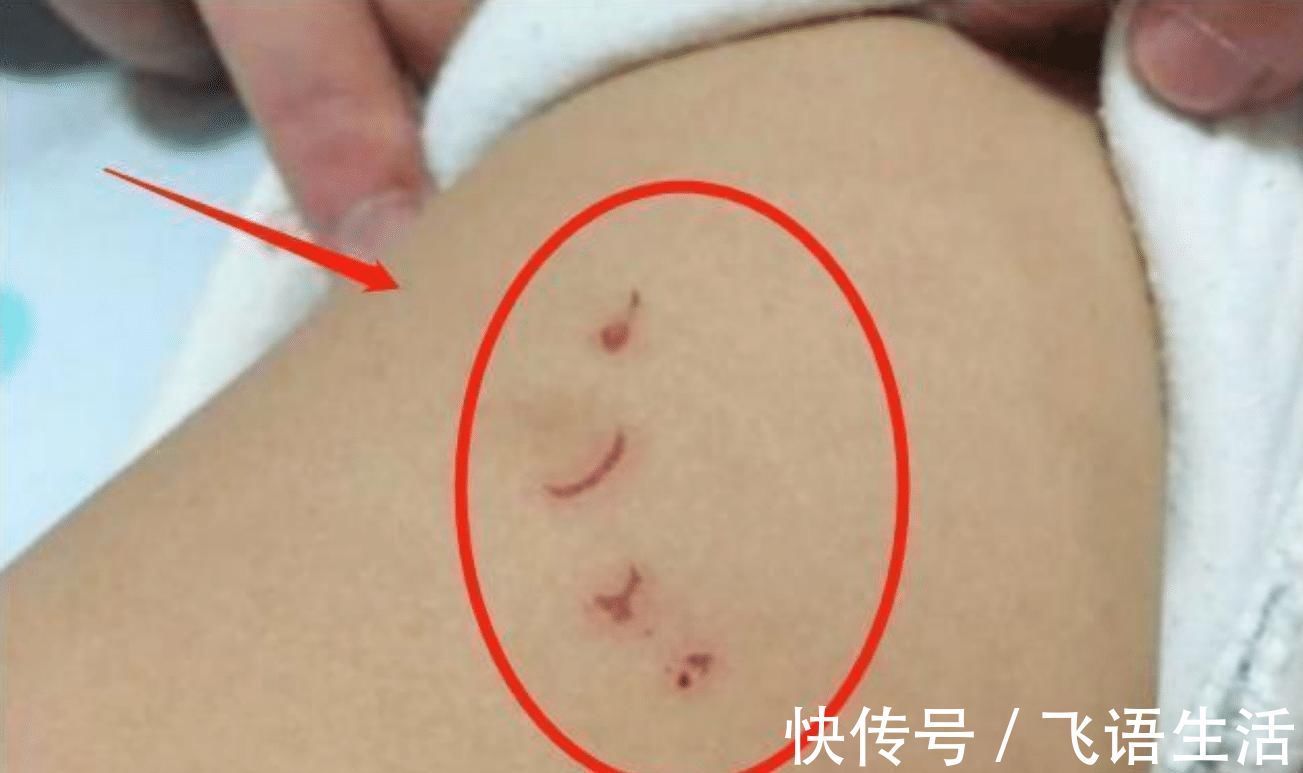 亲近|哥哥一亲近妹妹,妹妹却莫名哭闹,宝妈掀开妹妹衣服失声痛哭