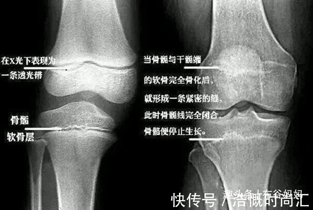 家长|53万儿童出现性早熟,家长多注意三方面,别过早地“催熟”孩子