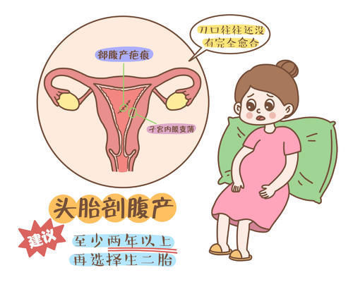 剖腹|为啥剖腹产二胎要比一胎更上心,过来人的经验之谈,孕妈要听进去