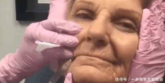 爱美之心|80岁奶奶打玻尿酸，仿佛年轻了40岁：老了也要美美的