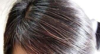 气血|经络不通百病生,一套从头练到脚的经络养生操,手把手教会您