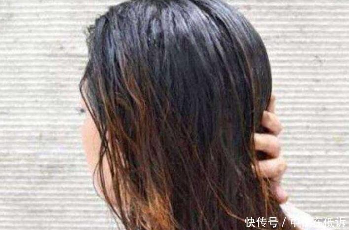 头发总是爱出油日常坚持做好3件事,摆脱头发油腻