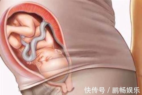 宝宝|剖腹产划伤宝宝,宝妈声讨无果,若想避免,准妈妈要注意这几点