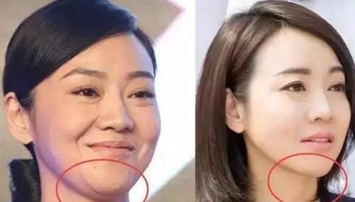 聊一聊有些人为什么会看上去脸越来越宽？看看具体的解决方案