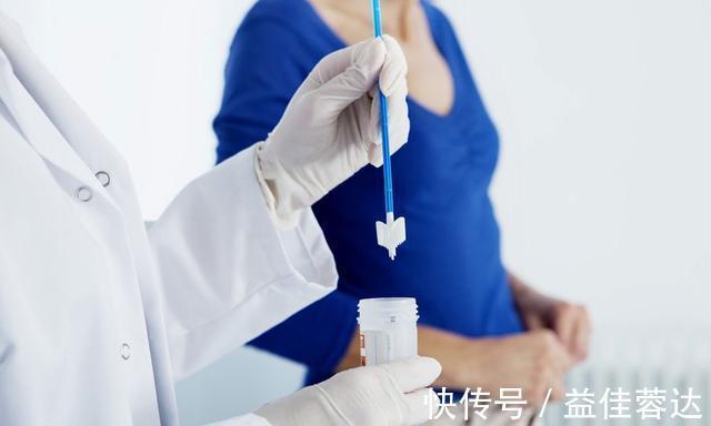 卵巢癌|5种严重的妇科肿瘤,医生希望你知道它们的症状