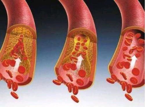 血管|56岁后,进入了“养寿期”,请护好这2处健康,尽量做到“3不做”