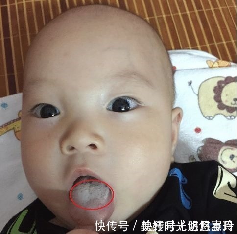 积食|如果宝宝发出这些表现,可能是暗示身体“积食”了,家长别忽视