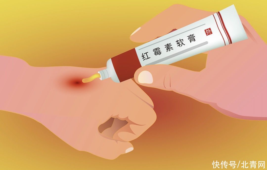 医生|你以为“红霉素软膏”抹哪里都行吗？医生紧急提醒