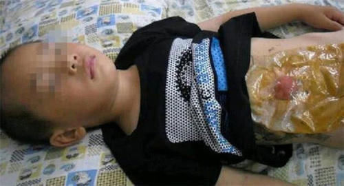 懂得|8岁男孩从来不在学校上厕所,受到同学嘲笑,掀开衣服后惹人心疼