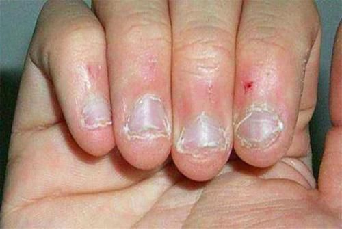 家长|爱“咬指甲”的孩子,长大后是什么模样?两种结局可预料