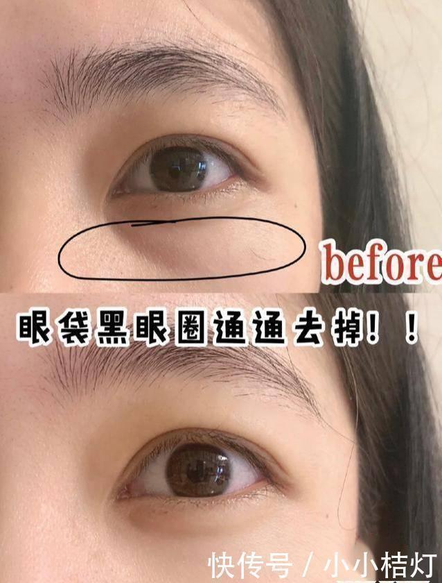 眼睛|建议女生涂眼霜时要避开这3点“误区”，不然眼霜再贵也没效果