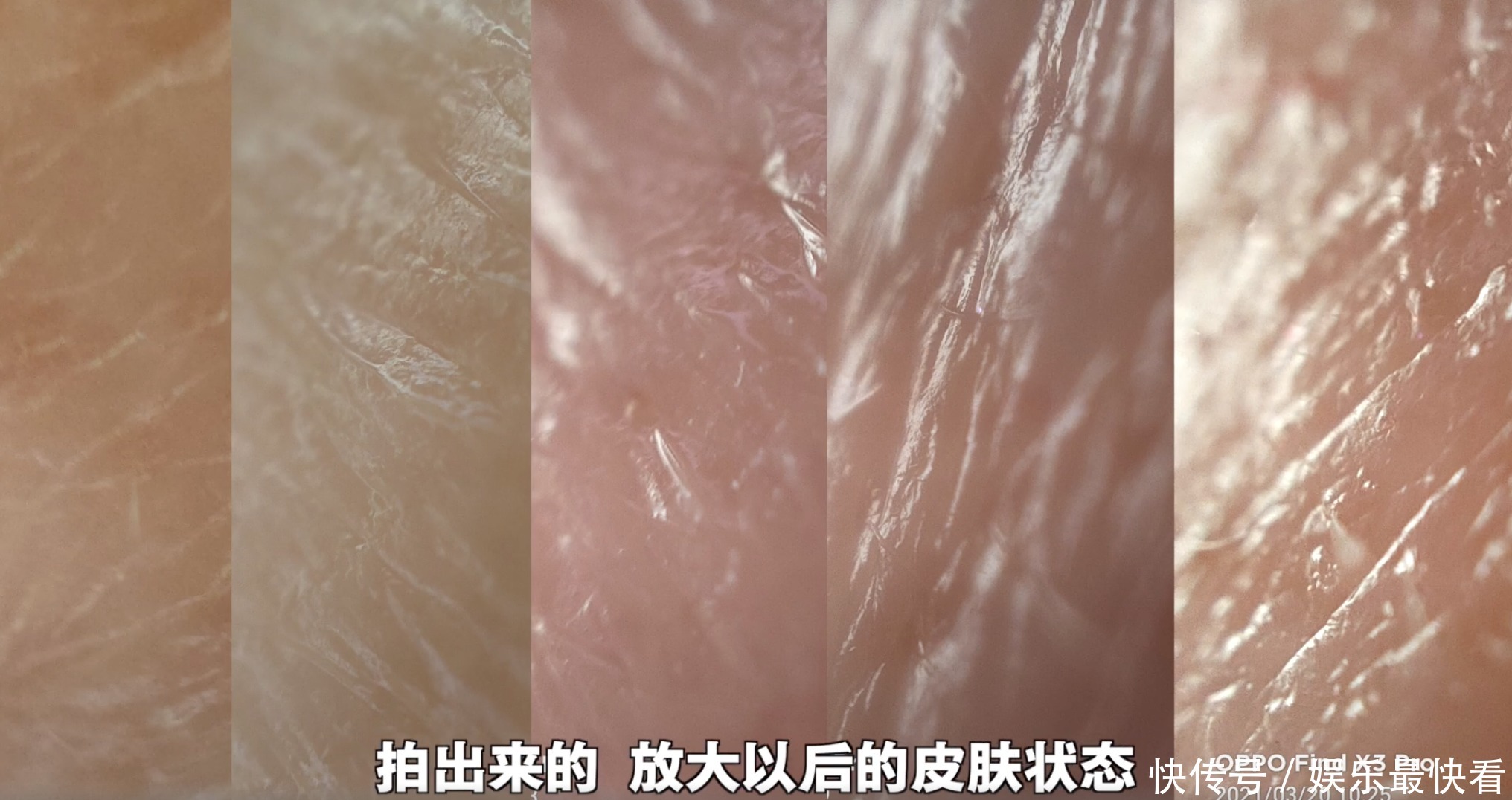 最近流行显微镜皮肤缺水测试?比美容院仪器还好使!直观又省钱