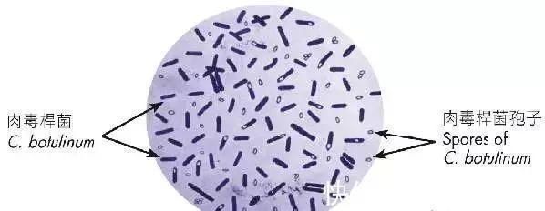 饮料|2种饮料被爆含“肉毒杆菌”,可致白血病,你家孩子还在喝吗