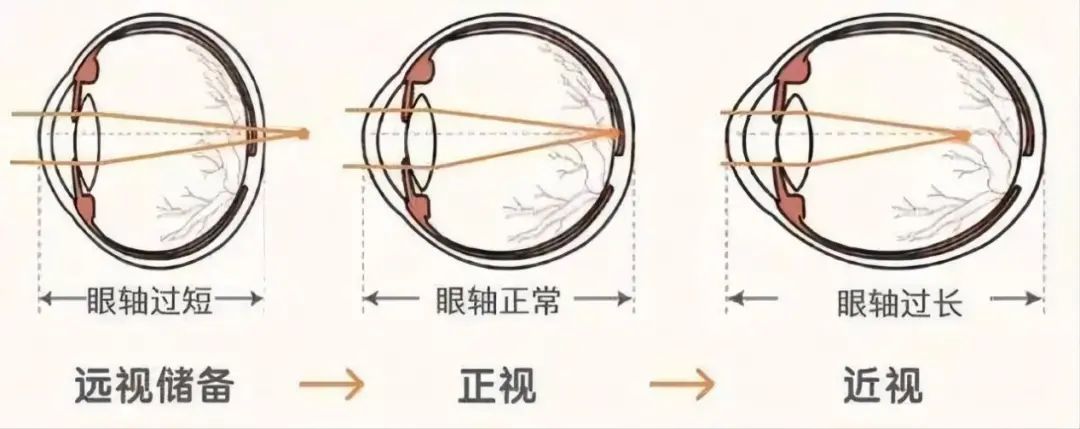 储备|每人天生有笔“存款”，限18岁前用！答案在眼睛里……