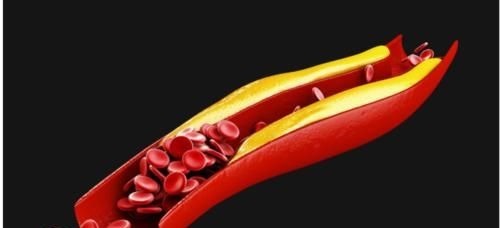 何首乌|一味中药坚持服用20天,就能把血脂降到正常