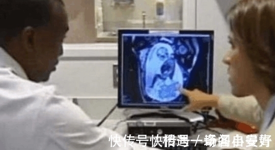 肚子|孕妇做产检却被告知肚中有肿瘤, 医生建议立刻动手术, 数月后孩子出生众人傻了眼