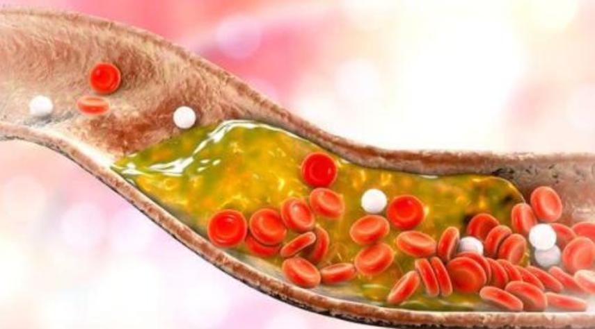 血栓|三大院士呼吁:90%的血栓无需治疗,常做两事或能预防血栓的形成