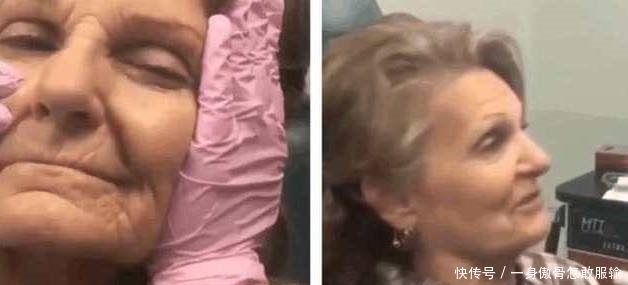 爱美之心|80岁奶奶打玻尿酸,仿佛年轻了40岁:老了也要美美的