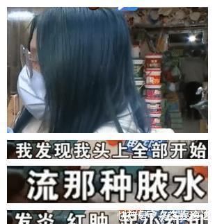 充值卡|染发偏色还发炎,反而埋怨顾客不懂行,顾客:怪我没选好颜色?